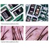 Skin Diagnosis Hair Analyzer, USB Digital Microscope DSP Handheld Skin
