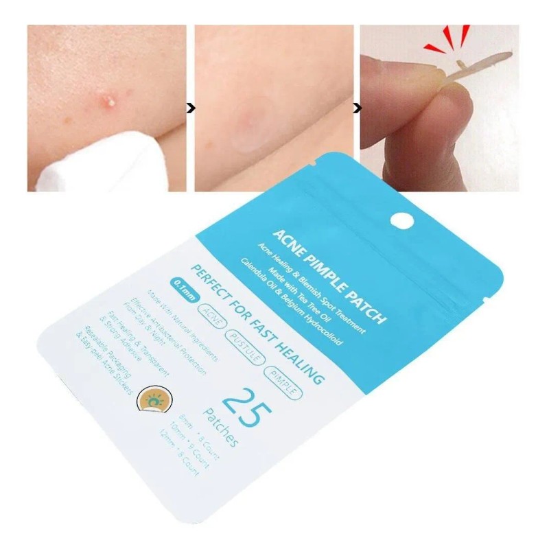 25 Parches Para Eliminar Cicatrices, Acné, Acné, Acné, Ma