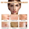 Jabón de Ácido Kójico con Cúrcuma y Limón, Barra Facial