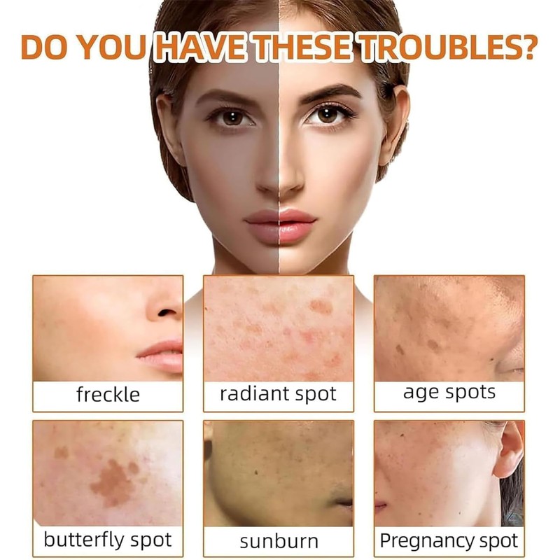 Jabón de Ácido Kójico con Cúrcuma y Limón, Barra Facial