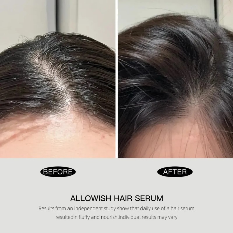 Sérum Capilar Allowish 95 Ml Oil Control Fuller Nourish