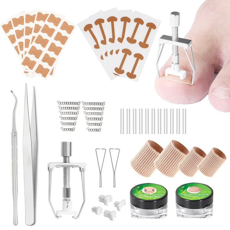 Ingrown Toenail Treatment Kit Glue Free Pedicure Ingrown Toenail Corrective