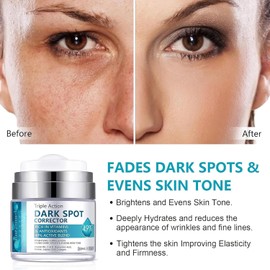 Dark Spot Remover for Face & Body, Dark Spot Remover, Dark Spot Corrector, Freckle Removel Cream, Reduces Hyperpigmentation, Age Spots, Sun Spot, Improve Skin Tone, for All Skin Types