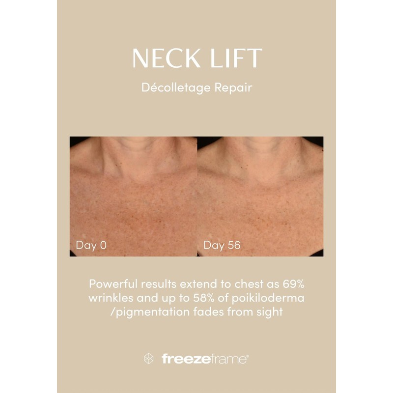 freezeframe Neck Lift 50ml