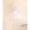 Hatherine Spot Care Patch Kit, 76 patches, 2 packs 해서린