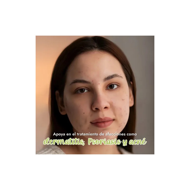 Hidrolato de caléndula puro tónico facial todo tipo de piel