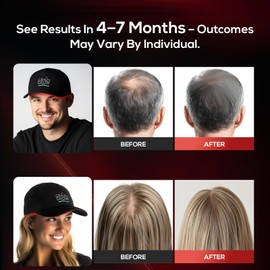 Laser Hair Growth Cap, Low Level Laser Therapy (LLLT) Device Designed to Promote Hair Growth in Women and Men,Laser Cap