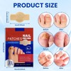 Pack of 42 Nail Patches for Toenails and Fingernails, Multi-Purpose