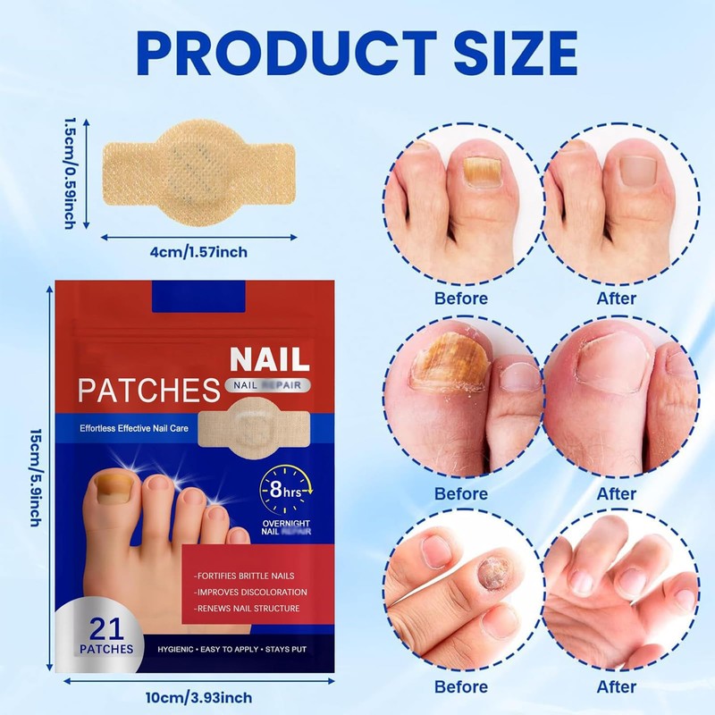 Pack of 42 Nail Patches for Toenails and Fingernails, Multi-Purpose