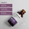 Natural Outcome Mandelic Acid Serum - 30 ml