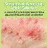 Universo en Línea Sérum Ácido Salicílico Antiacné Noche Rostro Cuello