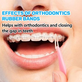 Orthodontic Rubber Bands, Pack of 300 Elastic Teeth Elastic Bands with 5 Placers for Braces, 5/16 Inch Orthodontic Elastics for Braces Dreadlocks Tooth Gap Braces