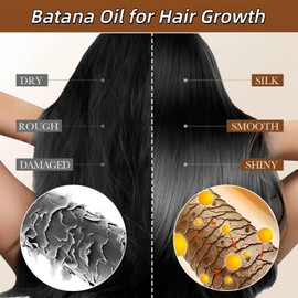 Bat/ana Oil for Hair Growth,Advanced Hair Growth Serum Hair, Natural Organic Bat/ana Oil,Hair Strengthening,Enhances Thickness,Moisturizes,Nourishing Volumizing,Repairs Damaged Hair,Prediluted