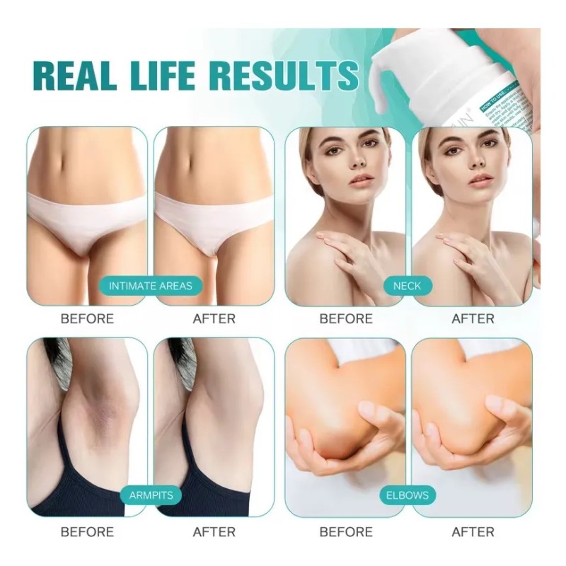 Crema Despigmentante Vaginal Peritoanal Axilas Entrepiernas Neutra