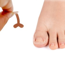 Ingrown Toenail Correction Band 12 Count 5ea