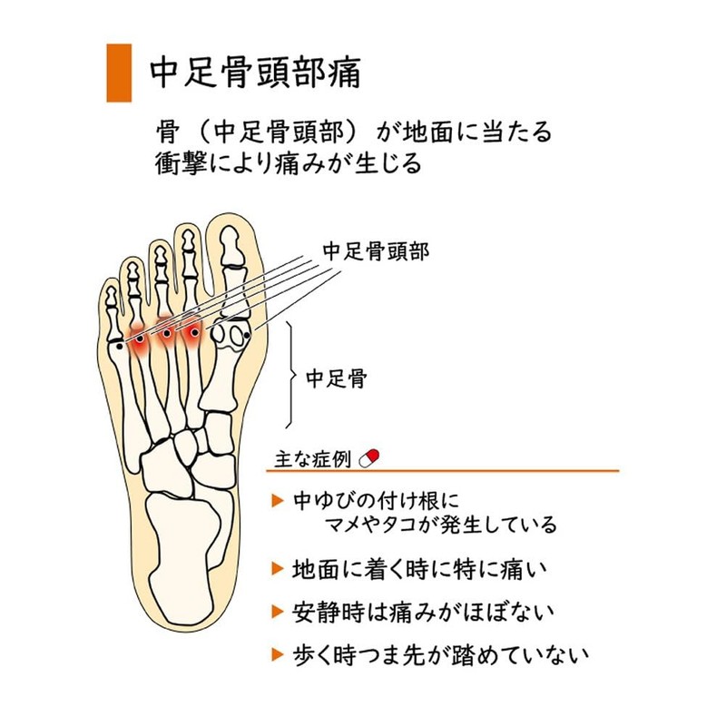 Foot Care Goods.COM Healthy Insole for Metatarsal Head Pain, Decompression