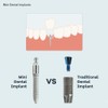 MDLMOR10Z MDLORZ Replacement O Ring Kit, for Intralock Mini Implant