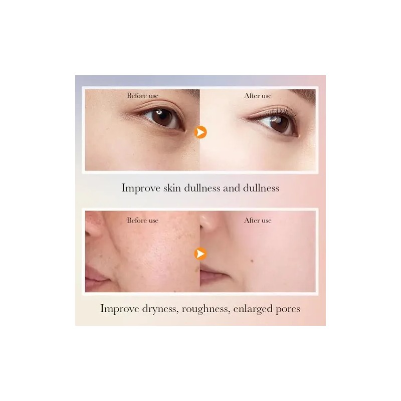 Skincare Set Uztuzt Hydrating W Vitamin C Niacinamide 6-p
