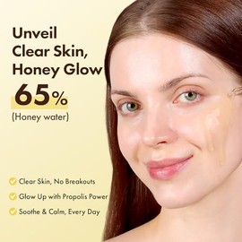 TOSOWOONG Honey Glow 65% Propolis Serum, Ácido Hialurónico, Ácido Kójico, Niacinamida, Hidratante Facial Calmante para Tono de Piel Irritado y Desigua