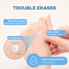 NOLAHOUR Spot Eraser Blue 100% Pure Hydrocolloid Patch Ultra Thin