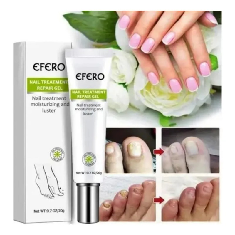 1pzs Crema Natural Hongos Uñas Pies Efero Gel Reparador 20ml
