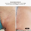 Bushbalm Ingrown Hair Routine - Roller Rescue, Nude Oil and