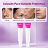 Crema Despigmentante Facial