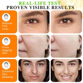 Vitamin C Serum Face 60 ml Powerful 20% Vitamin C Serum Against Dark Spots, Wrinkles & Fine Lines, Face Care, Dark Circles Removal, Anti-Ageing, Collagen Boost & Skin Whitening