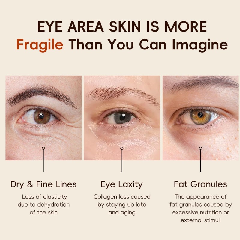 Vitamin C Eye Roller Serum for Dark Circles & Puffiness,Eye