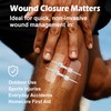 Ourmed Wound Closure Strips(2.4"x 2.8" - 4 Pcs), Butterfly Bandages