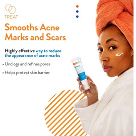 Suero rejuvenecedor AcneFree Retinol Blemish Mark con ácido hialurónico y niacinamida Ayuda a reducir la aparición de marcas de acné Control de enrojecimiento 1 onza