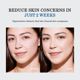 345 Relief Cream, 345 Relief Crema Anti-Azúcar y Anti-Oxidación, Reparadora de la Barrera Cutánea, Hidratante Facial Calmante, para Solucionar los Defectos de la Piel e Hidratar 50ml