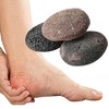 Volcanic Rock Foot Callus Remover Stone for Heel Care and Exfoliation Stone 5ea