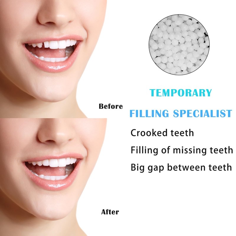 100g Tooth Filling Repair Beads, Tooth Filler Temporary Filling, Thermal