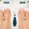 Slant Edge Toenail Clipper Set for Thick Nails – Stainless