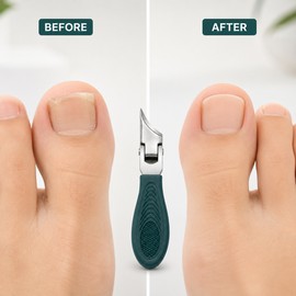 Slant Edge Toenail Clipper Set for Thick Nails – Stainless Steel Eagle Beak Nail Trimmer Kit for Home Care