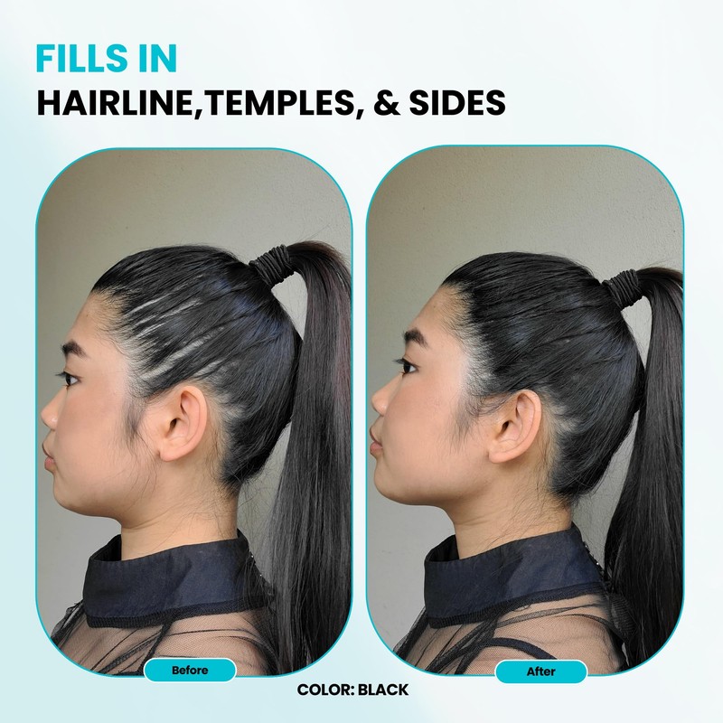 SURETHIK Hair Fibers, 15g (Black), Fills Thinning Hair for Visibly