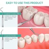Dental Instruments Universal Probe Scaler - Double Ended Tartar Remover