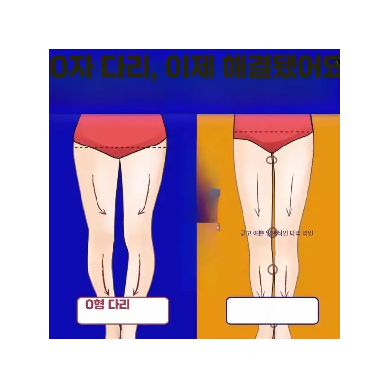 Trendbooth 트렌드부스 오자다리교정기 오자다리 교정기 휜다리 [블랙 XXS 60-70cm] Trendboos