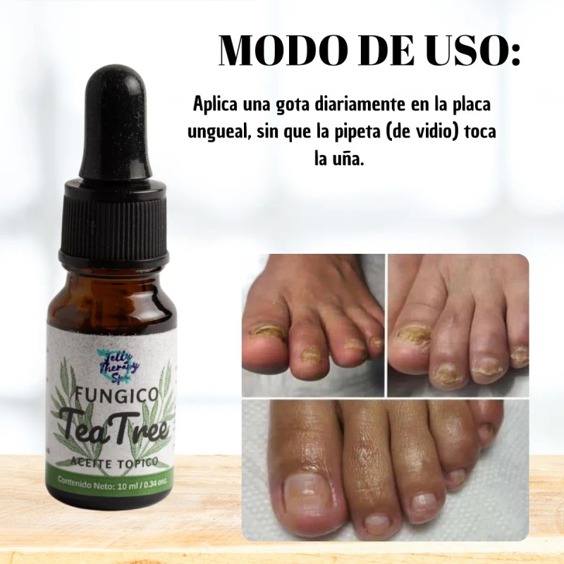 Fungicida Arbol Del Te Para Uñas Con Hongos Y Pie