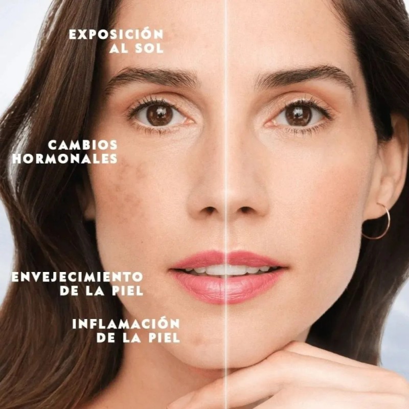 2 Cremas Blancoderma Quita Manchas Piel Facial Aclarador Bla Mixta