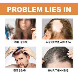 Tkekruh 7 x Hair Strengthening Ampoules 2 ml, Hair Growth Serum, Hair Growth Agent for Women and Men, Anti-Hair Loss, Serum for Thicker, Longer, Fuller and Healthier Hair, Hair Serum