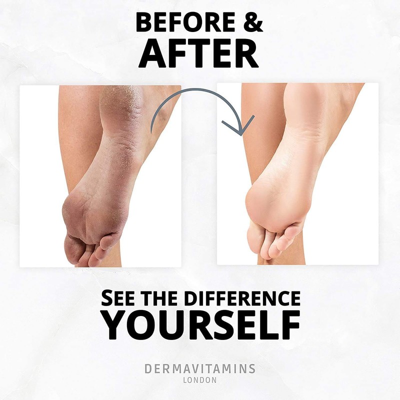 Dermavitamins Advanced Moisturising Foot & Hand Mask Bag Set