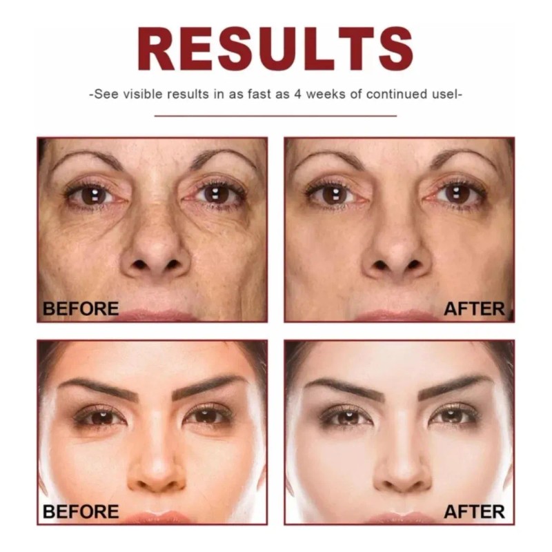 Retinol B3 Sérum Antienvejecimiento 30 Ml Jaysuing