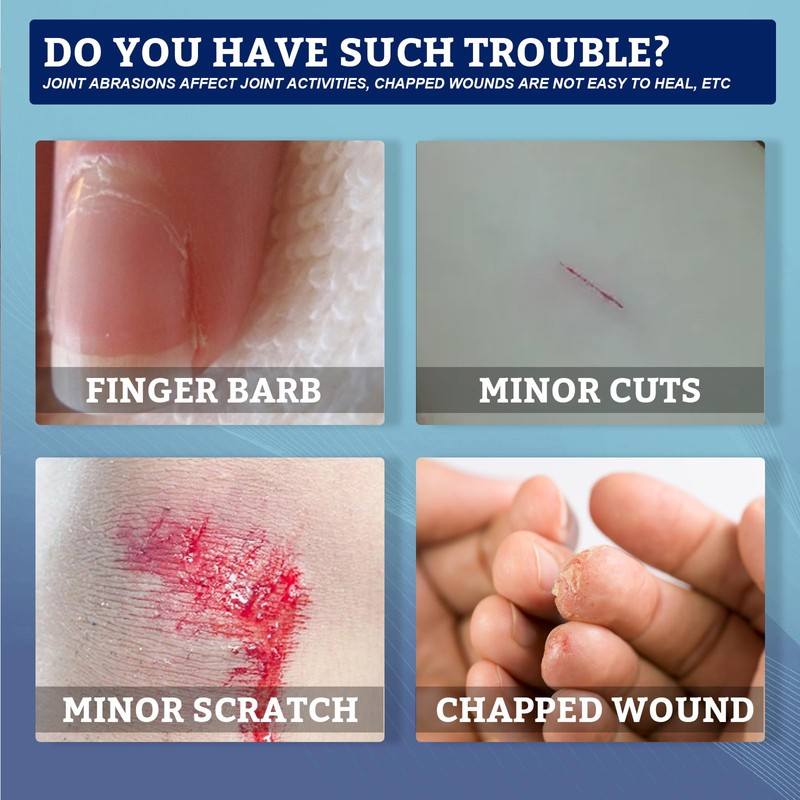 KOAHDE Wasserfester Hautkleber Für Kratzer,Band-Aid,Wasserdichtes Flüssigpflaster für die Haut,Flüssigpflaster Reduziert