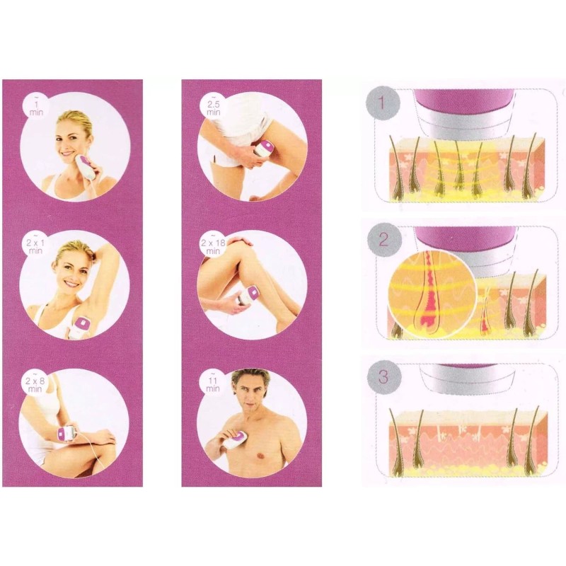 VitalControl IPL100 Permanent Hair Reduction, Hair Removal Device Epilator Perm.