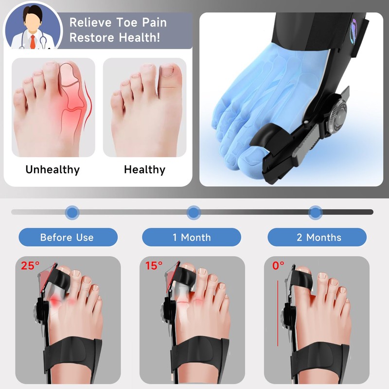 HUQKIYA Bunion Corrector for Women & Men, Orthopedic Bunion Splint