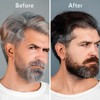 Generic Generic Anti-Gray Hair Serum With Arcolys, Melanogray, Black Seed