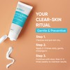 Butt Acne Clearing Treatment Cream: Clears & Prevents Breakouts Fast