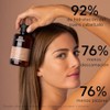Apivita | Shampoo Contra las Caspas Secas 250ML